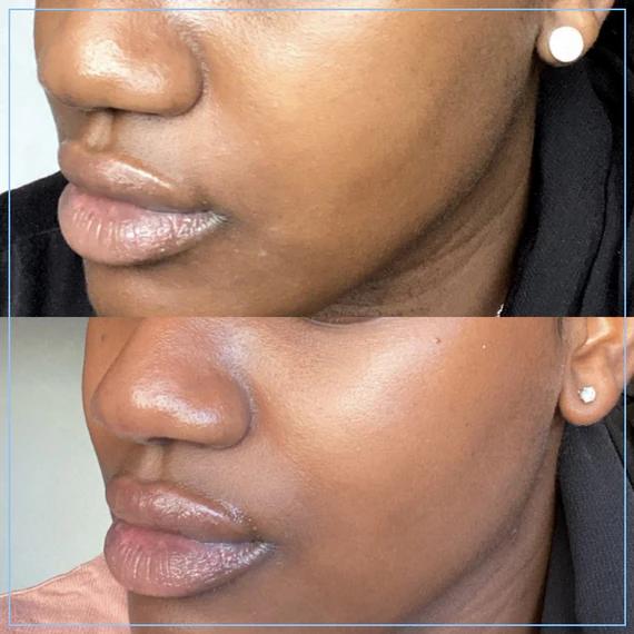 Skingredients Aha Cleanser Parent - Image 9