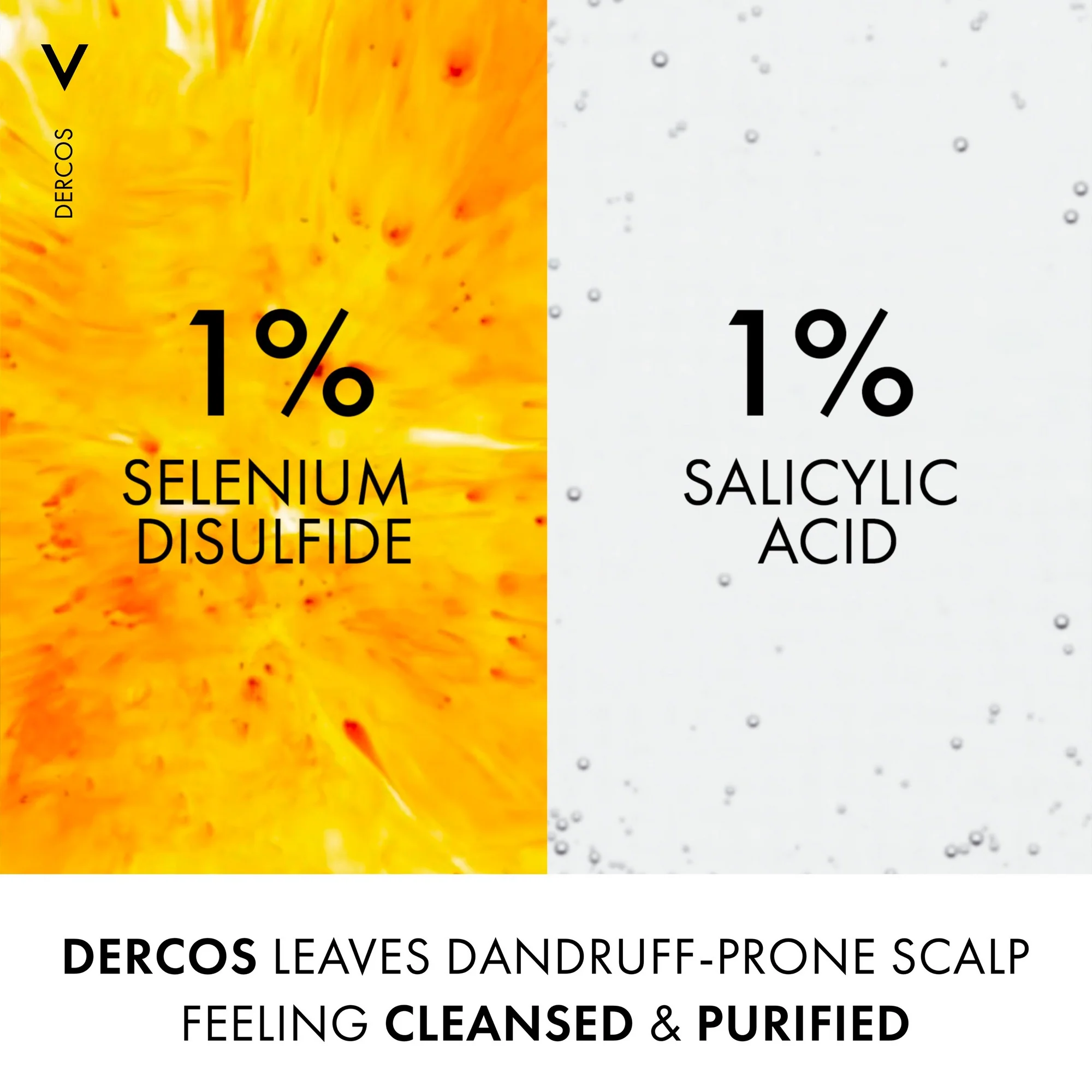 Vichy Dercos Anti-Dandruff Shampoo Dry Hair 200ml - Image 6