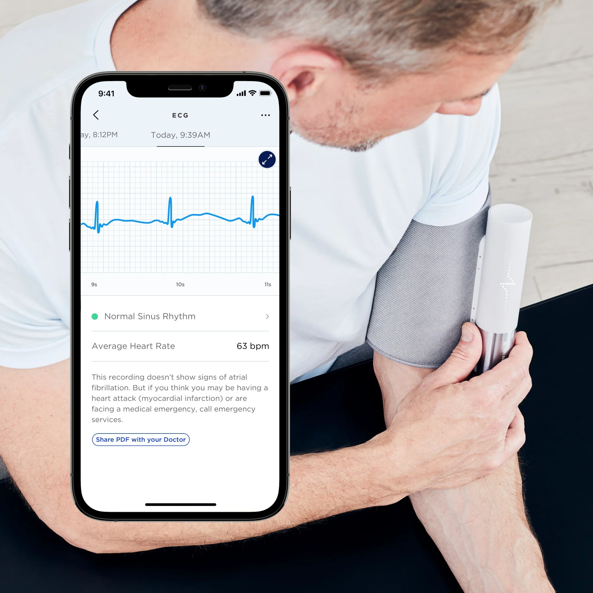 Withings Bpm Core Smart Blood Pressure Monitor - Image 5